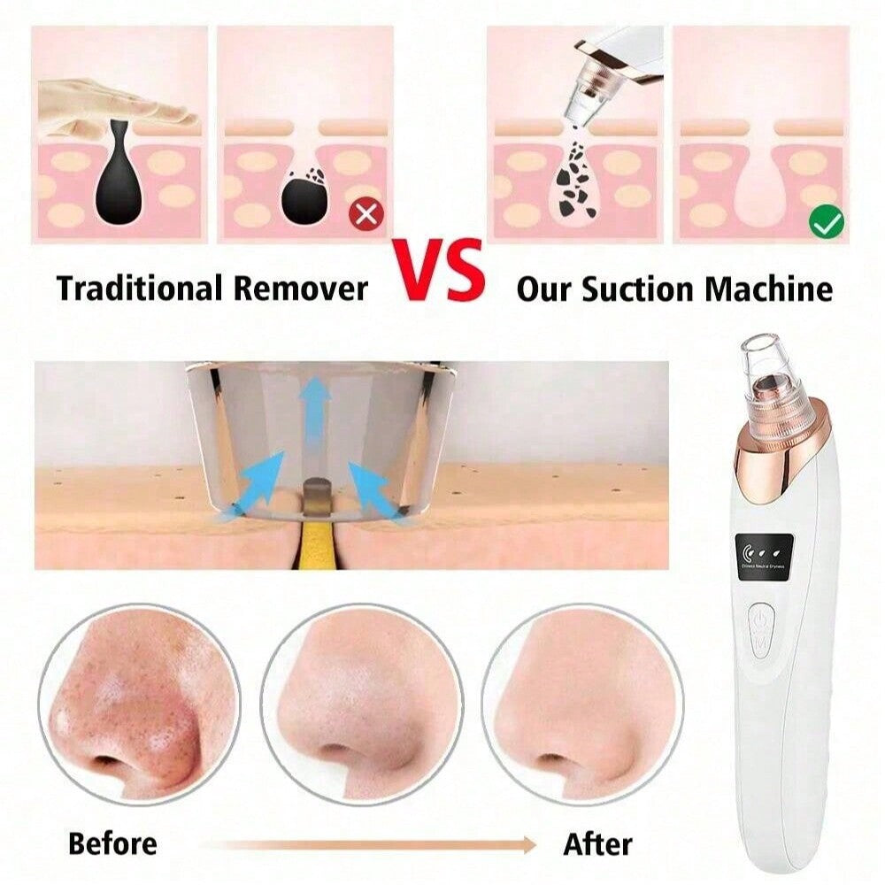LUXELE™ – Electric Acne Pore Cleaner & Blackhead Remover